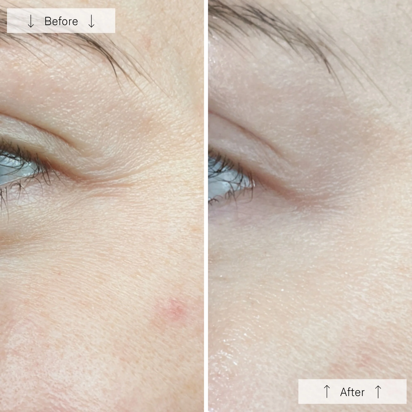 Omnilux Contour Face Mask