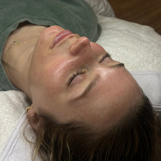 Client after acne facial treatment results at Baby Face Skin Bar Northern Kentucky