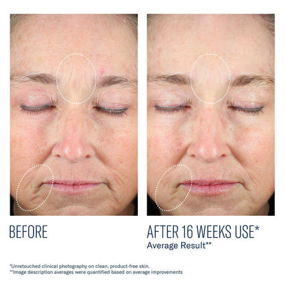 Mystro Revive Renewing Serum