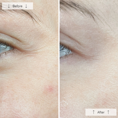 Omnilux Contour Face Mask